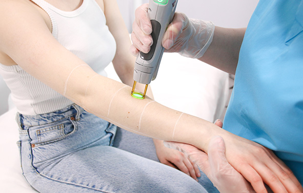 A Laser Technician is Processing Laser Hair Removal Treatment on Patient's Hand