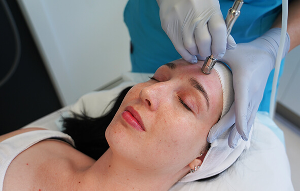 microdermabrasion process