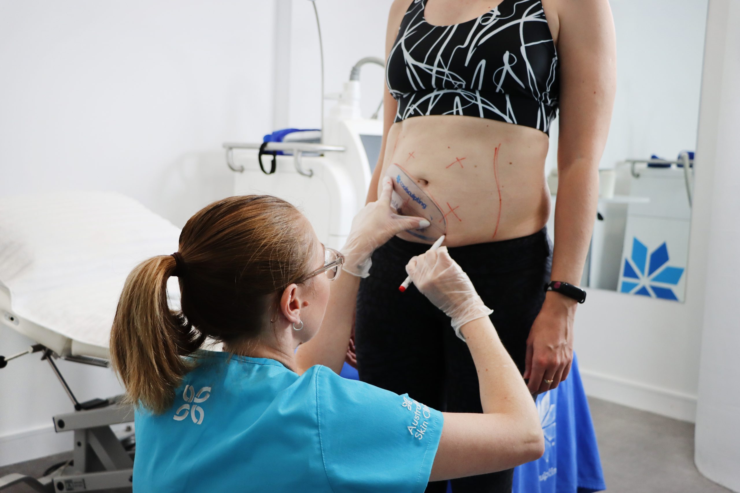 What happens at a Coolsculpting® consultation?