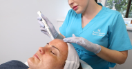 MesoInfus™ Needling - Face Featured Image